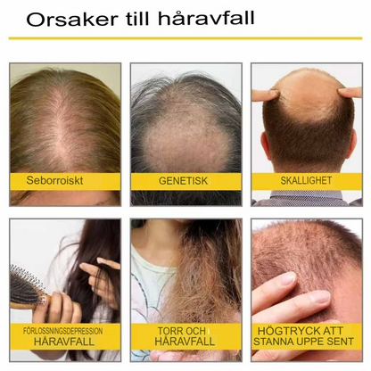 DenseFlow - Essentiell Hårväxtolja | Naturlig Lösning för Tätare Hår