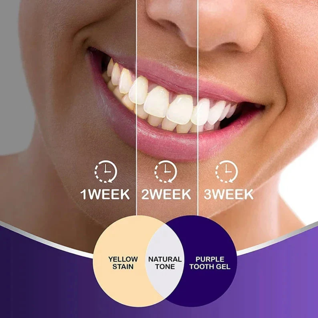 RadiantSmile | Avancerat V34 Tandblekningsserum