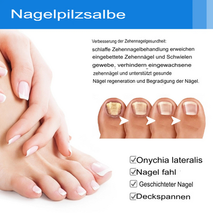Fungex | Nagelpilz-Creme – Schnelle & Schmerzfreie Hilfe!