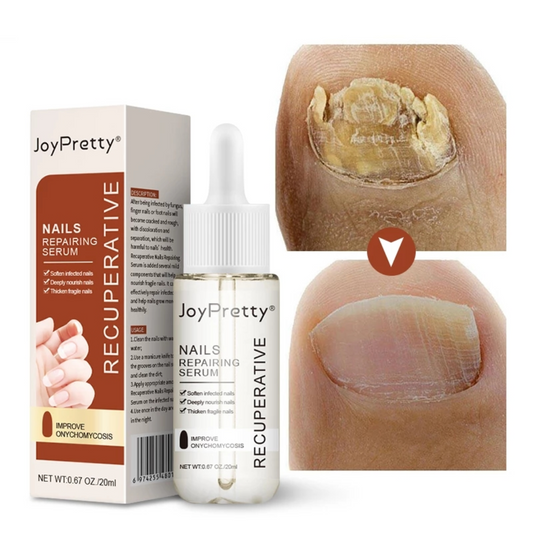 Nailcure | Omedelbar lösning mot nagelsvamp – Beställ nu! 💅🦠