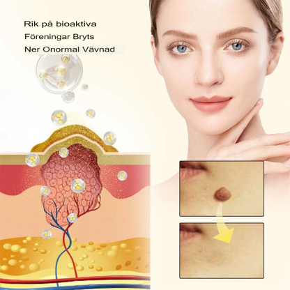 SkinClear | Bivene Behandlingskräm för Vårtor och Molar